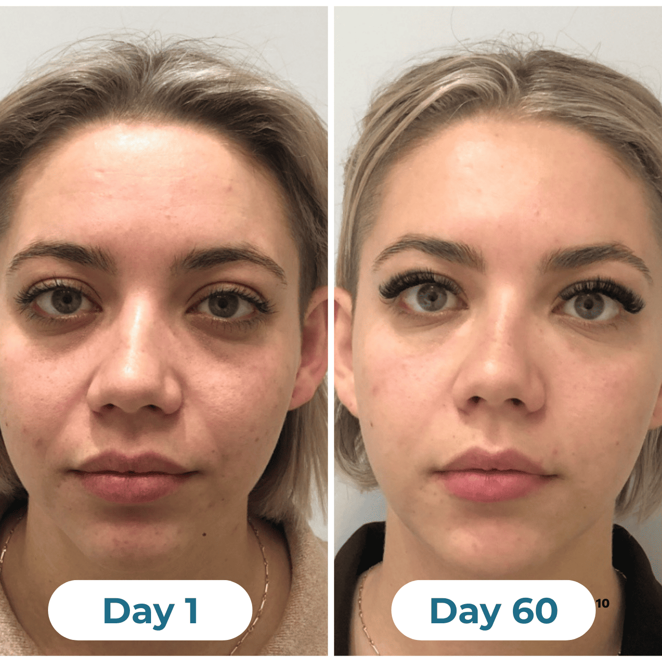 Depuff Drainage Drops - HealthSpren