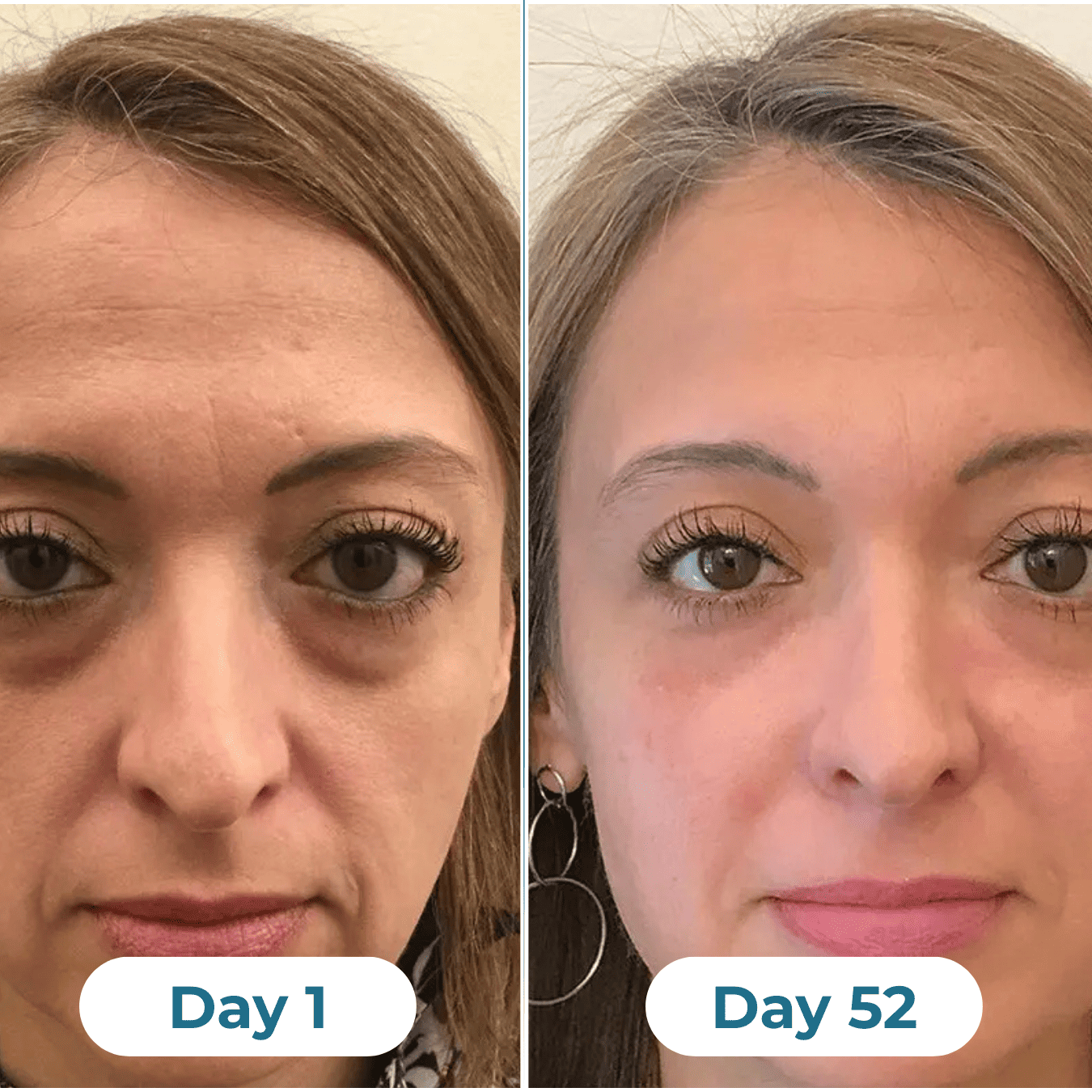 Depuff Drainage Drops - HealthSpren