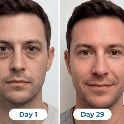 Depuff Drainage Drops - HealthSpren