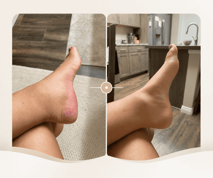 Depuff Drainage Drops - HealthSpren