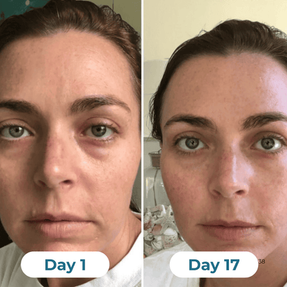 Depuff Drainage Drops - HealthSpren