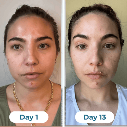 Depuff Drainage Drops - HealthSpren