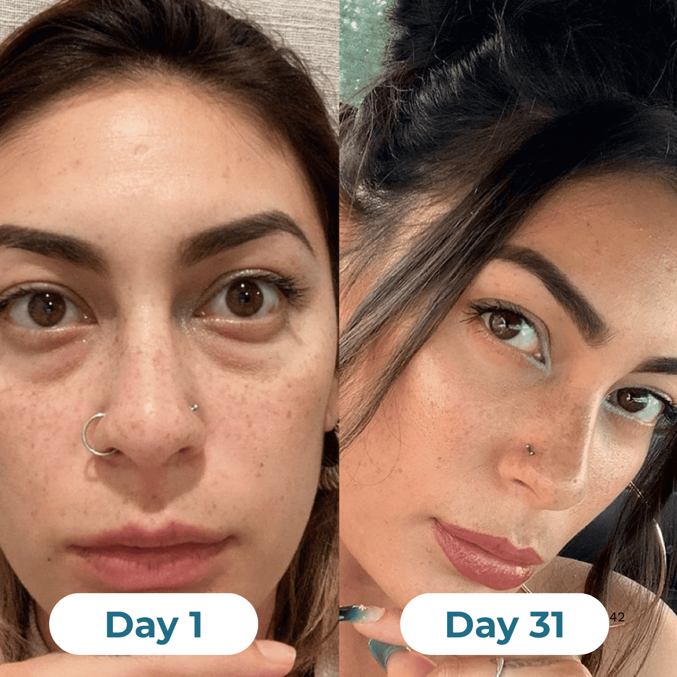 Depuff Drainage Drops - HealthSpren