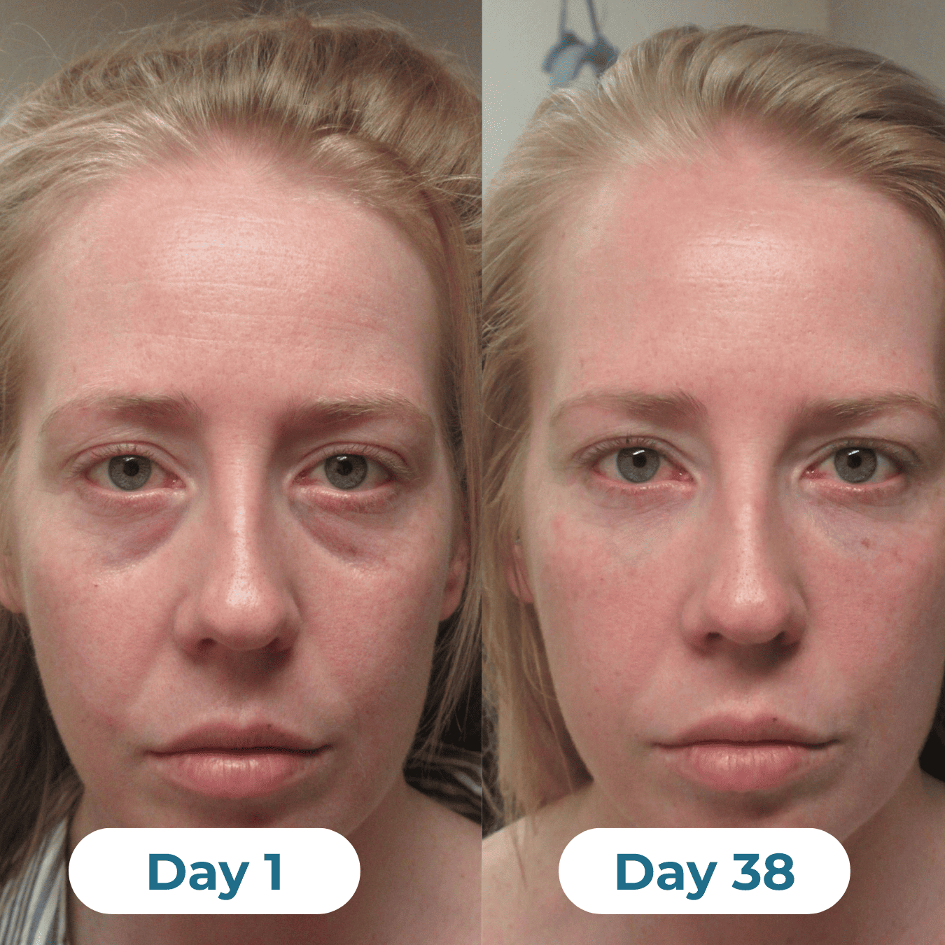 Depuff Drainage Drops - HealthSpren