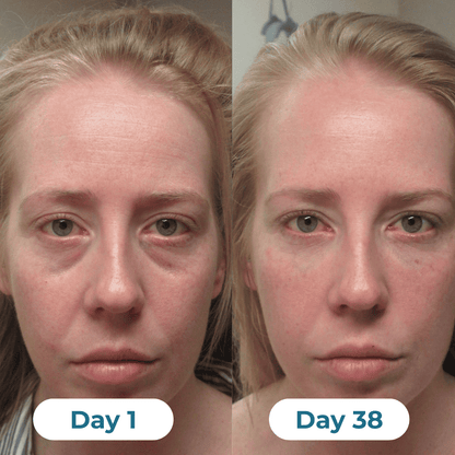 Depuff Drainage Drops - HealthSpren